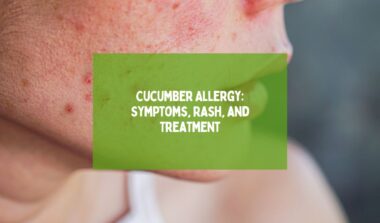 Cucumber Allergy Symptoms, Rash, and Treatment