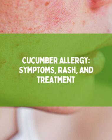 Cucumber Allergy Symptoms, Rash, and Treatment