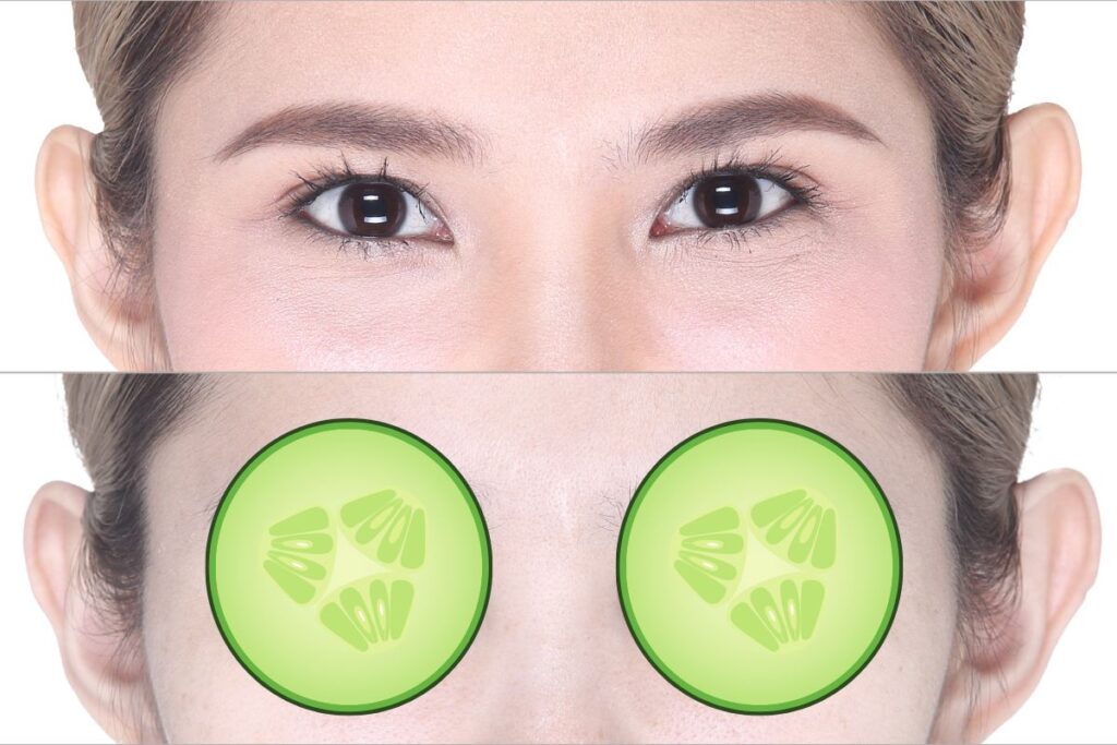 Cucumber on eyes before and after